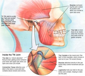 What Are the Symptoms of Jaw Pain?