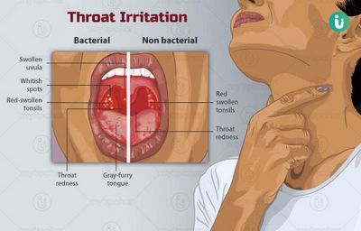 What Causes Itchy Throat?